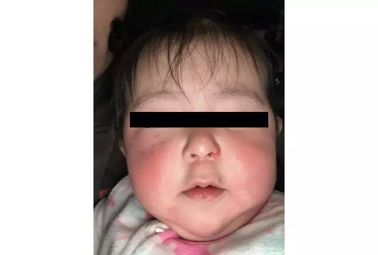 Guardería entrega a bebé fuertemente golpeada, en Mérida