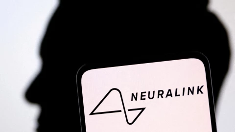 chip-cerebral-neuralink-elon-musk