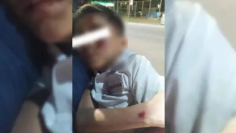 Atropellan a estudiante de seis años