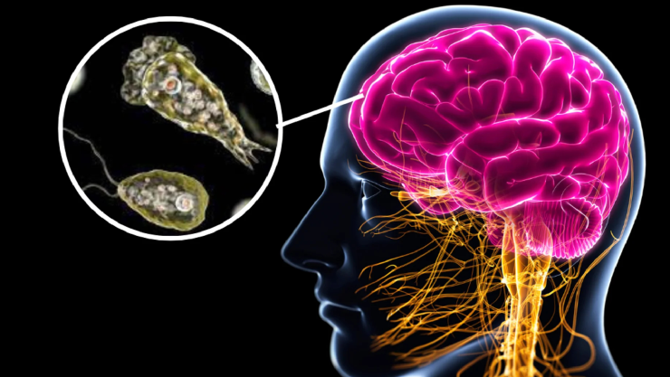 Ameba Comecerebros.jpg