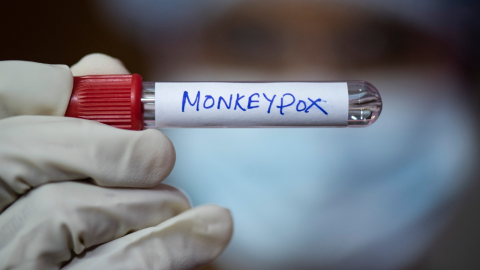 nueva variante de mpox