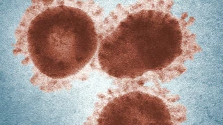 Confirman brote mortal del virus Marburgo: qué es y cuáles son sus síntomas