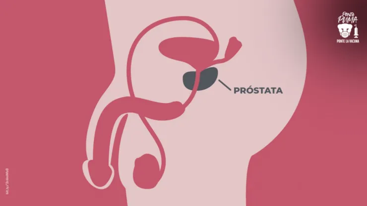 Cáncer-de-próstata (1).jpg