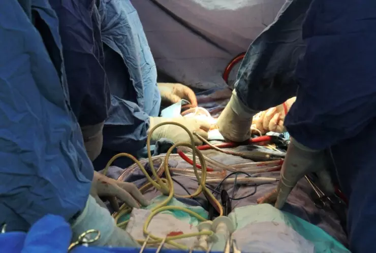 IMSS trasplante corazón