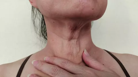 Así puedes recuperar elasticidad y rejuvenecer tu piel