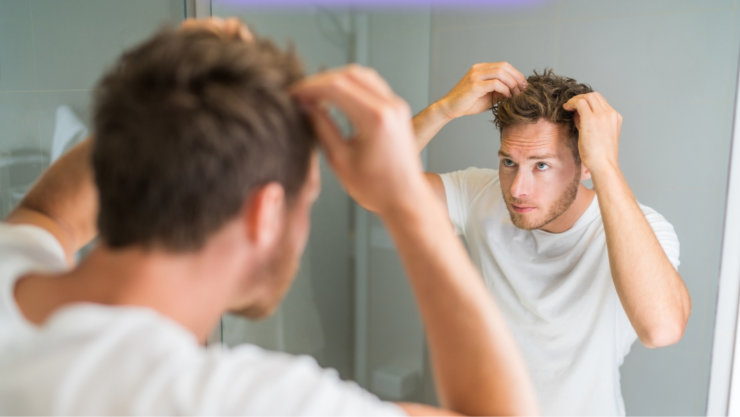 A qué edad empiezan los hombres a perder cabello.