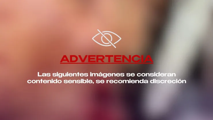¿Quién es la mujer a la que le dieron un balazo en la cabeza hoy en el fraccionamiento Las Américas?
