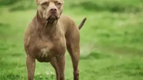 Mujer PIERDE la PIERNA tras brutal ataque de su perro en su casa