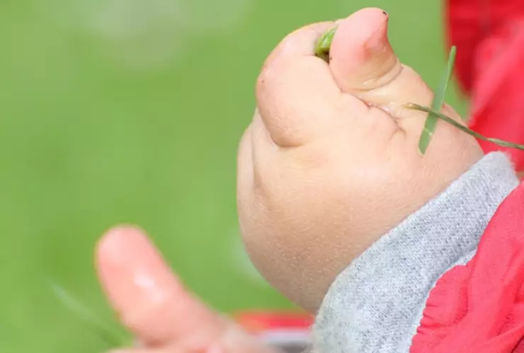 muere niño atropellado atlixco