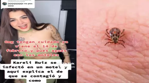 Karely Ruiz con ácaros