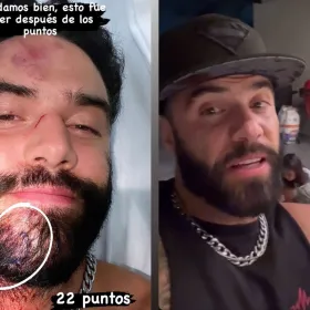 Fernando Lozada revela en La Granja VIP el TERRIBLE asalto que sufrió