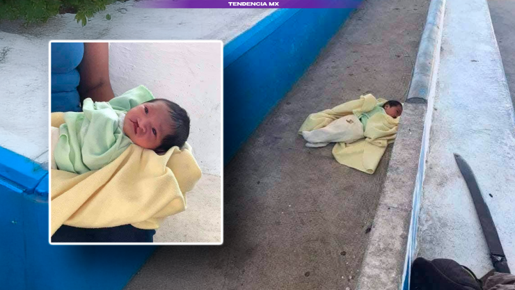 Bebé con labio leporino abandonado