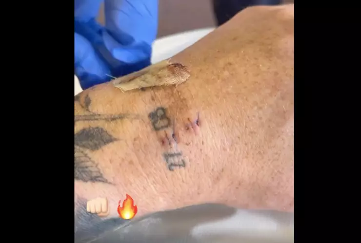 Canelo Álvarez operacion mano izquierda