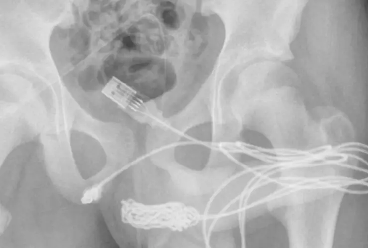 Se mete cable USB por el pene.jpg