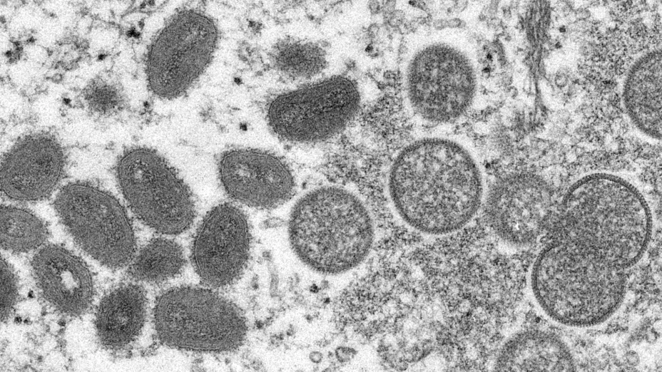 Virus de la viruela símica vista en microscopio.