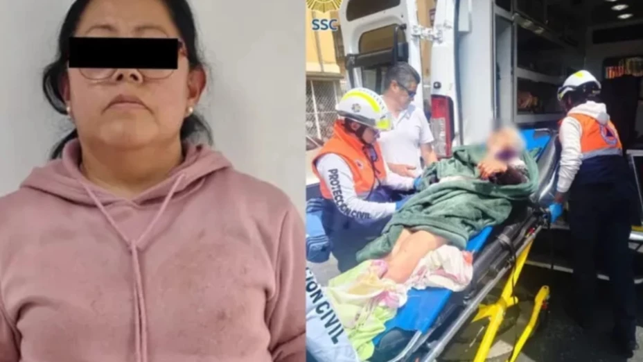 Mujer sufre AMPUTACIÓN por ataque de perro pitbull; la dueña del animal ya fue detenida