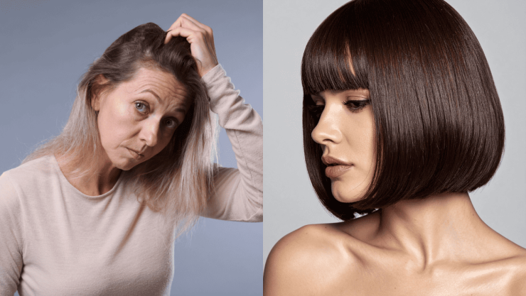 5 cortes de pelo con los que podrás disimular las entradas.png