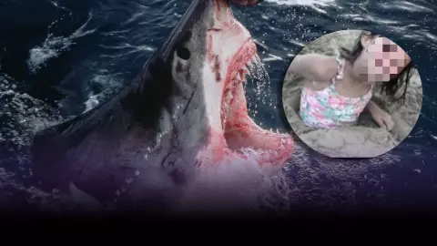 ¡Tragedia en el mar! Niña de 8 años pierde la pierna tras ATAQUE de un tiburón
