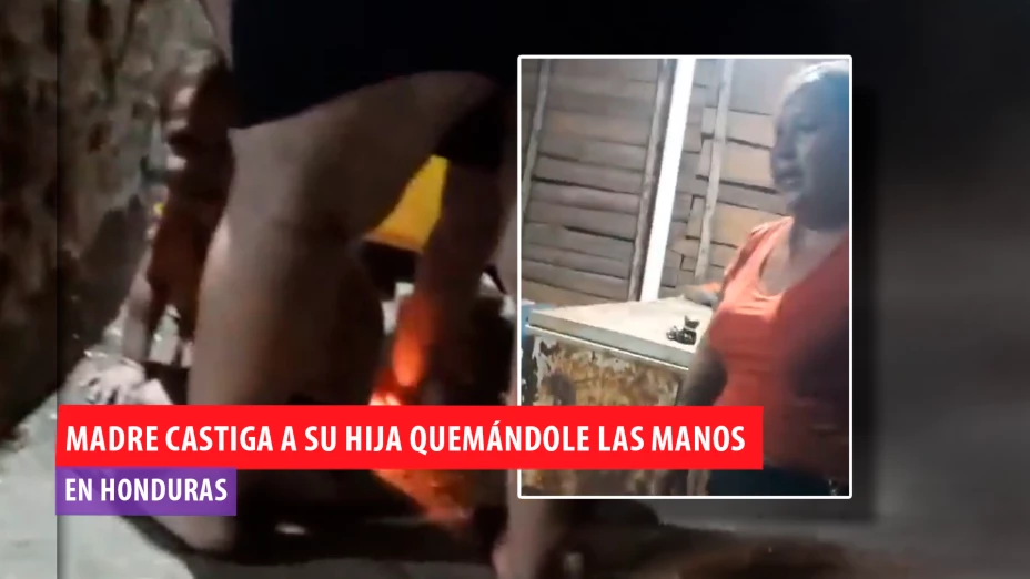 Terror en Honduras: Madre castiga a su hija quemándole las manos