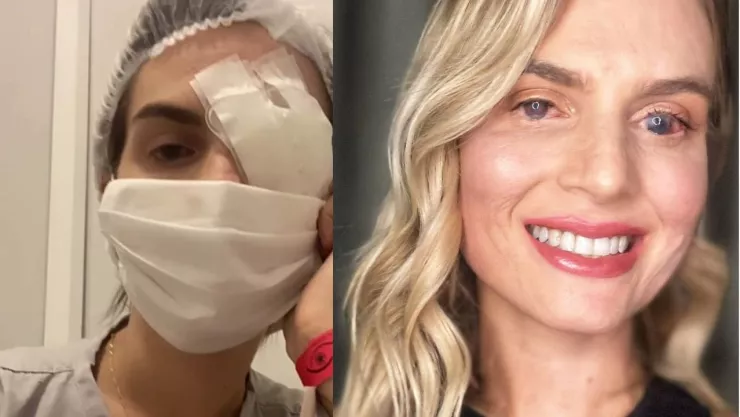 MUJER EN BRASIL ENTRA EN COMA