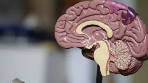 ¿Cuál es la enfermedad autoinmune que padece Sabine Moussier_ ¿Es esclerosis múltiple_.?