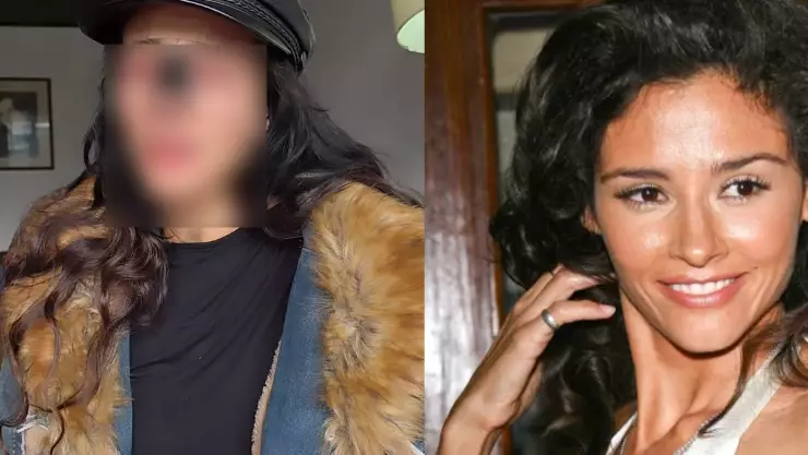 Dorismar muestra su rostro desfigurado tras cirugía estética fallidas