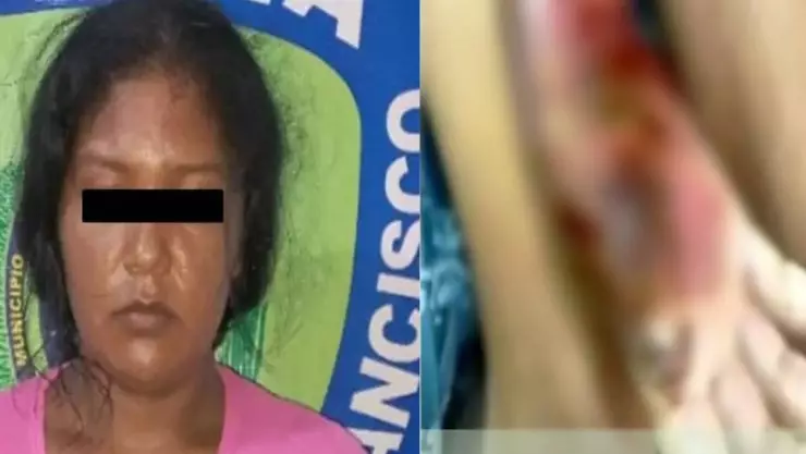 Mamá le quema la mano a su hija de castigo
