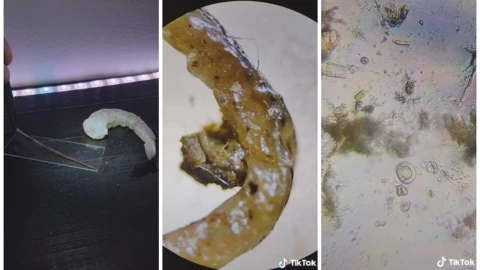 Camarón, microscopio, TikTok 1.jpg