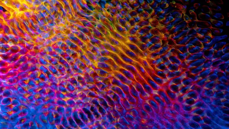 LSD y cerebro: qué efectos puede tener después del “viaje”