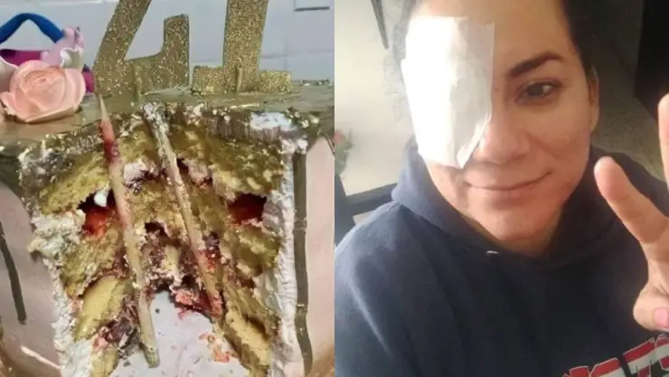 Mujer se entierra varilla de pastel de cumpleaños.