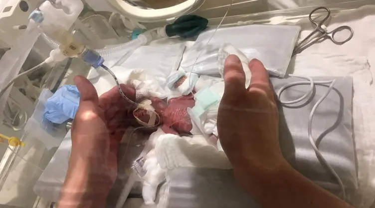 bebe