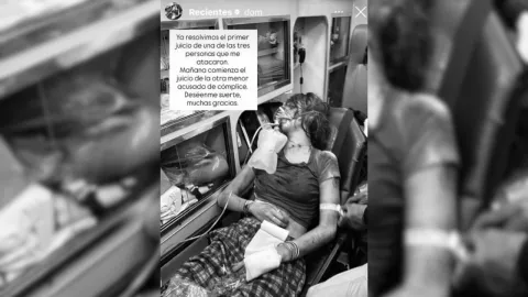 Valentina Gilabert publica foto tras el ataque y revela avances del proceso contra Marianne Gonzaga