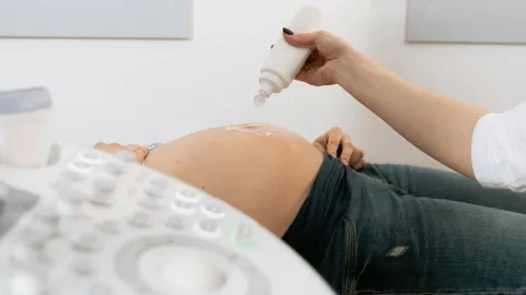 Médico realizando un ultrasonido a una mujer embarazada