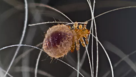 Dónde hacen nido las piojos y las liendres? Así viven si no están en las cabezas