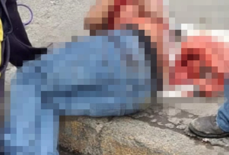 hombre baleado 7 sur loma bella 6 junio