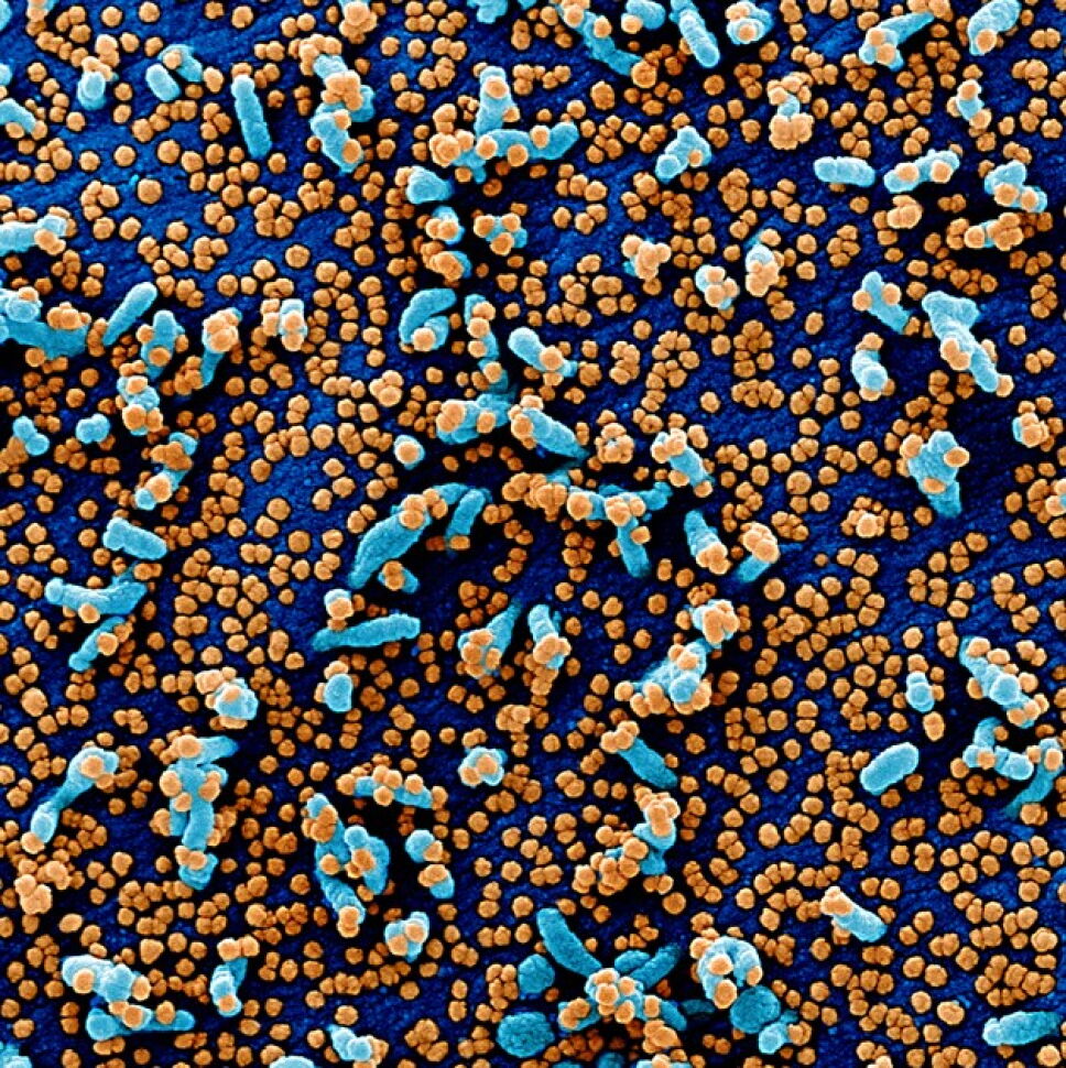 Fotos Asi Se Ve En Un Microscopio El Covid 19 Danando Celulas Humanas El primer tipo de microscopio que se creo fue el microscopio optico, el cual actualmente es. microscopio el covid