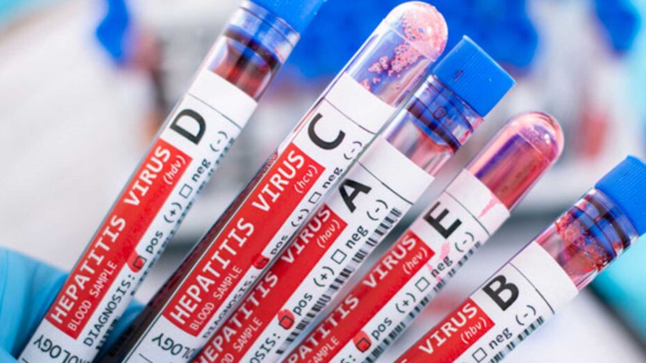 Tipos de hepatitis