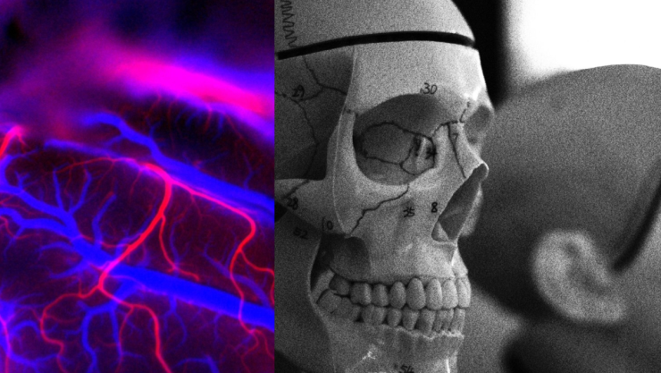 China desarrollará implantes de chips cerebrales como Neuralink de Elon Musk