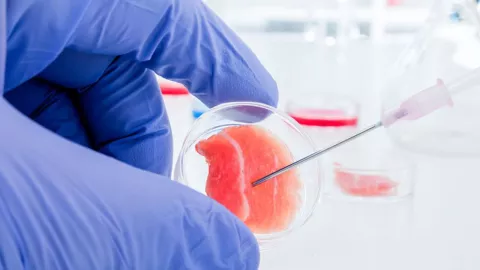 VIH: ¿Cómo fue que se curó el tercer paciente en el mundo?