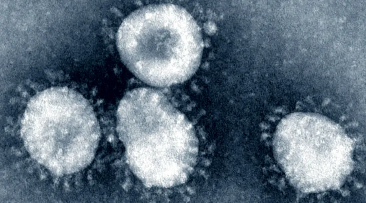 coronavirus