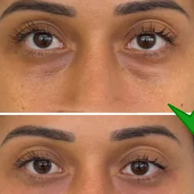 Cómo elegir subtono de corrector para maquillar las ojeras