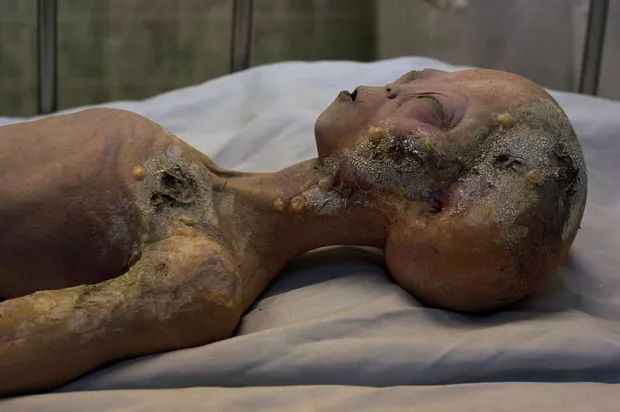 800px-Roswell_alienautopsy.jpg