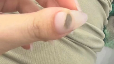 Mujer con hongo pierde uña por manicure mal hecho, video viral.png