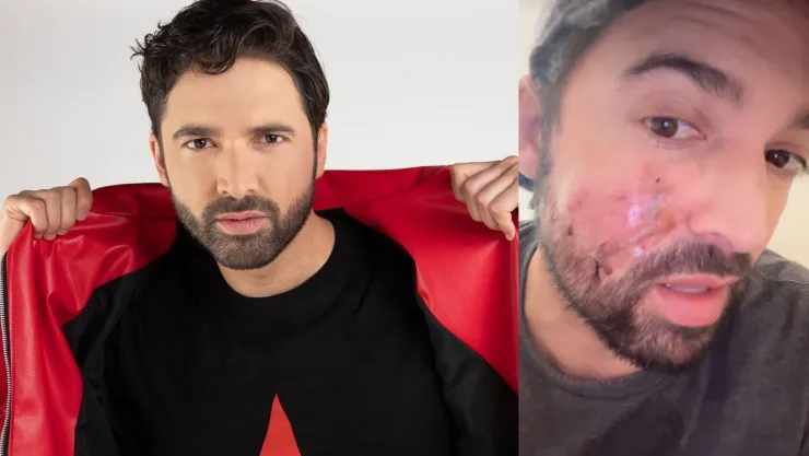 Carlos Girón enfrenta ataque de un perro y se somete a cirugía