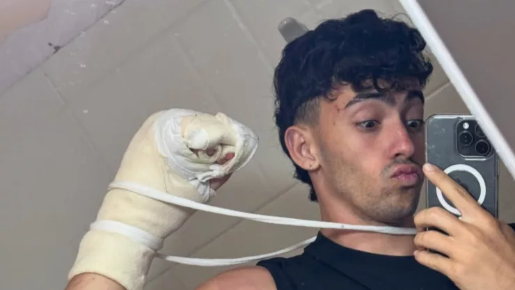 famoso-influencer-pierde-dos-dedos-sufrir-accidente.jpg