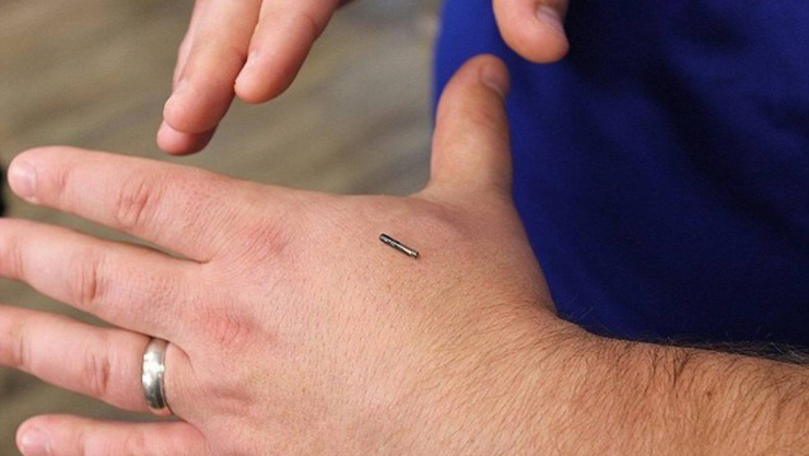 microchips-mano.jpg
