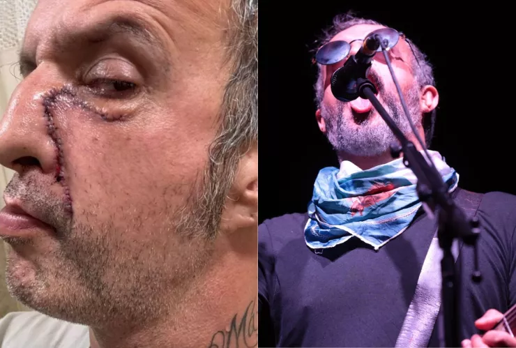 Tito Fuentes regresó a los escenarios.