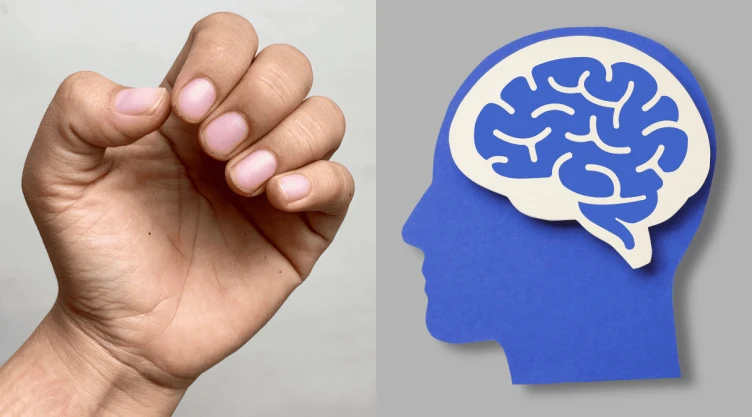 ¿Qué significa comerse las uñas según la psicología.png