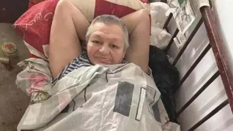 Mariana, perdió sus piernas por el ataque de ratas