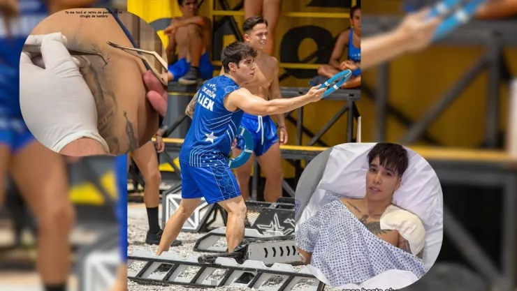 Alex Sotelo rompe el silencio y muestra cómo va sanando su cuerpo tras la dolorosa cirugía